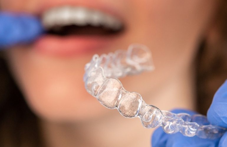 Invisalign Cost